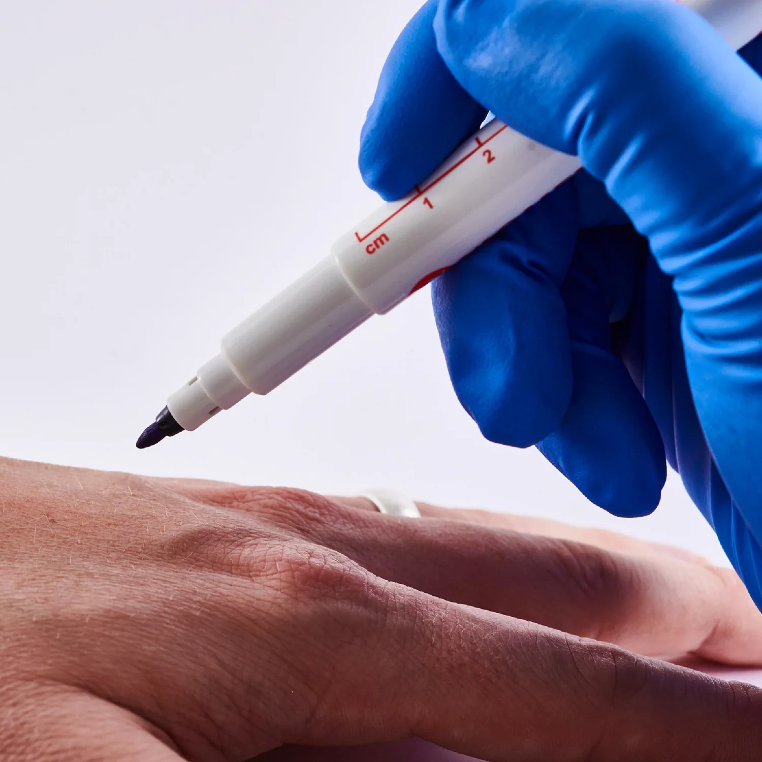 Surgical Skin Marker Pen